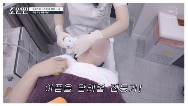 How to Decide Whether to Get Ulthera Under Sedation image 2
