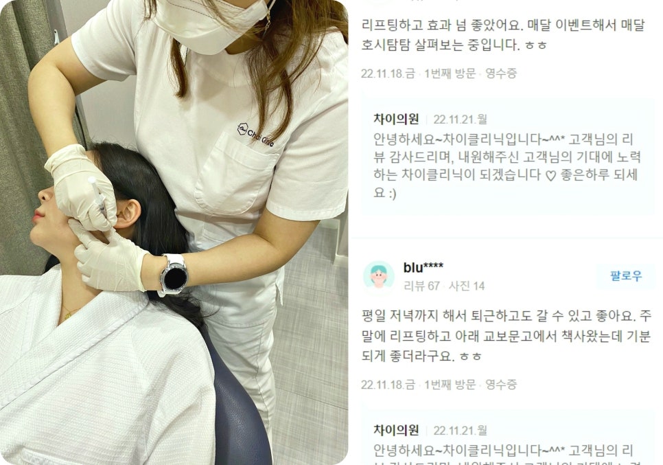 처진볼살리프팅 관련 이미지 12