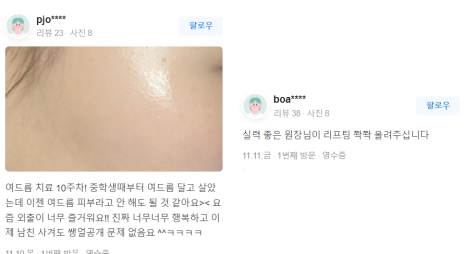 고주파레이저 생기넘치는 피부탄력의 비밀 관련 이미지 14