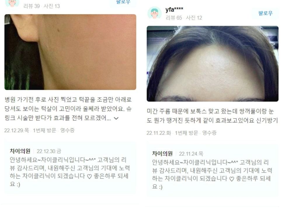 실루엣소프리프팅, 젊음의 생생함을 찾고 싶은 여러분에게 소개합니다. 관련 이미지 9