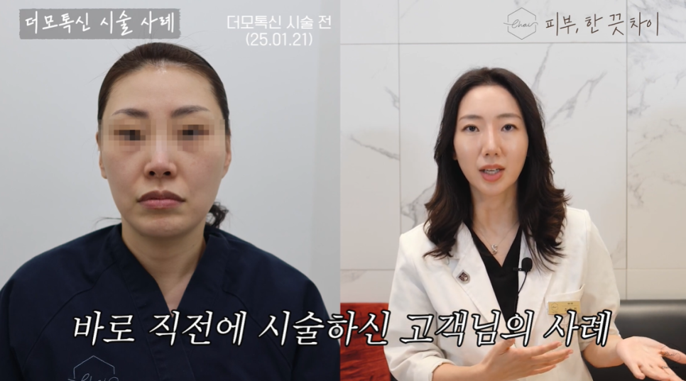 3 Things You Need to Know If You Don’t Want Botulinum Toxin Treatment in Hapjeong to Leave You Asymmetrical image 8