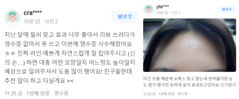 홍대여드름흉터 제거 가장 효과적인 제거 방법은? 관련 이미지 16