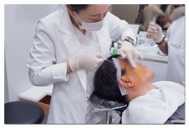 How to Choose the Right Treatment for Buccal Fat Lift by Type image 3
