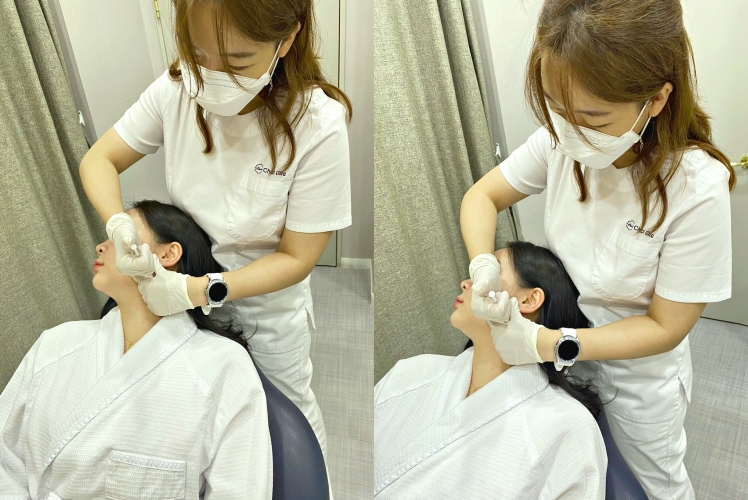 사각턱보톡스가격? 좋은 변화보기 위해 알아야 할 팁 관련 이미지 5