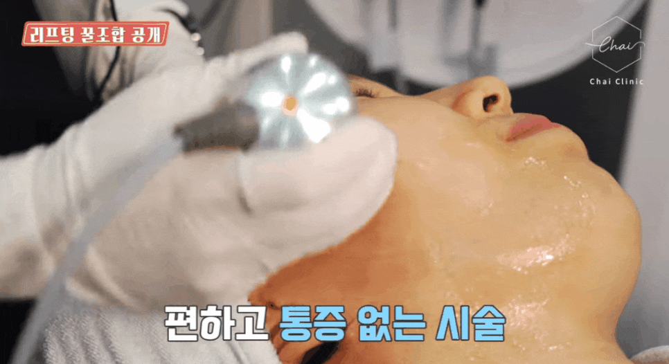 피부관리레이저종류 합정 울써마지까지 한방에 정리! 관련 이미지 16