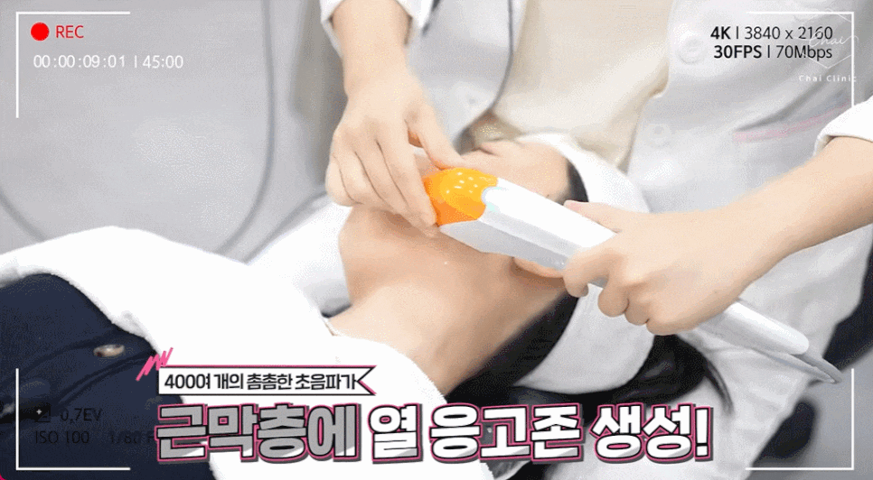 홍대슈링크 탄력 채우고 자신감 찾고 싶다면 관련 이미지 5