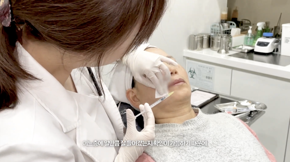 눈밑 쥬베룩 볼륨의 효과와 유지기간 관련 이미지 15