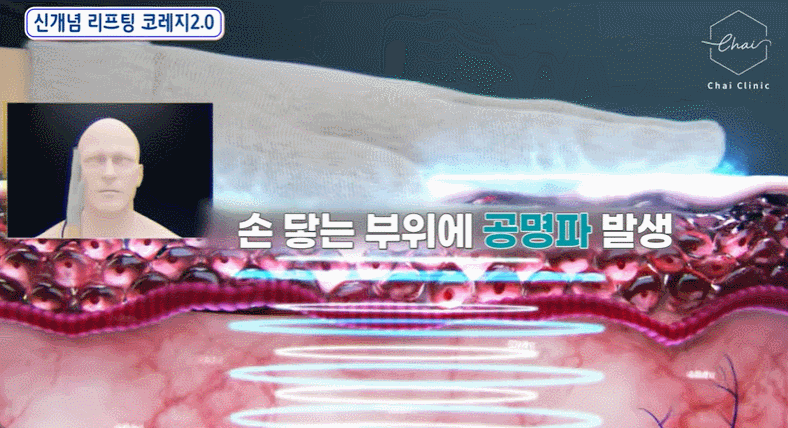 울써마지가격과 효과 모두 알려드립니다 관련 이미지 11