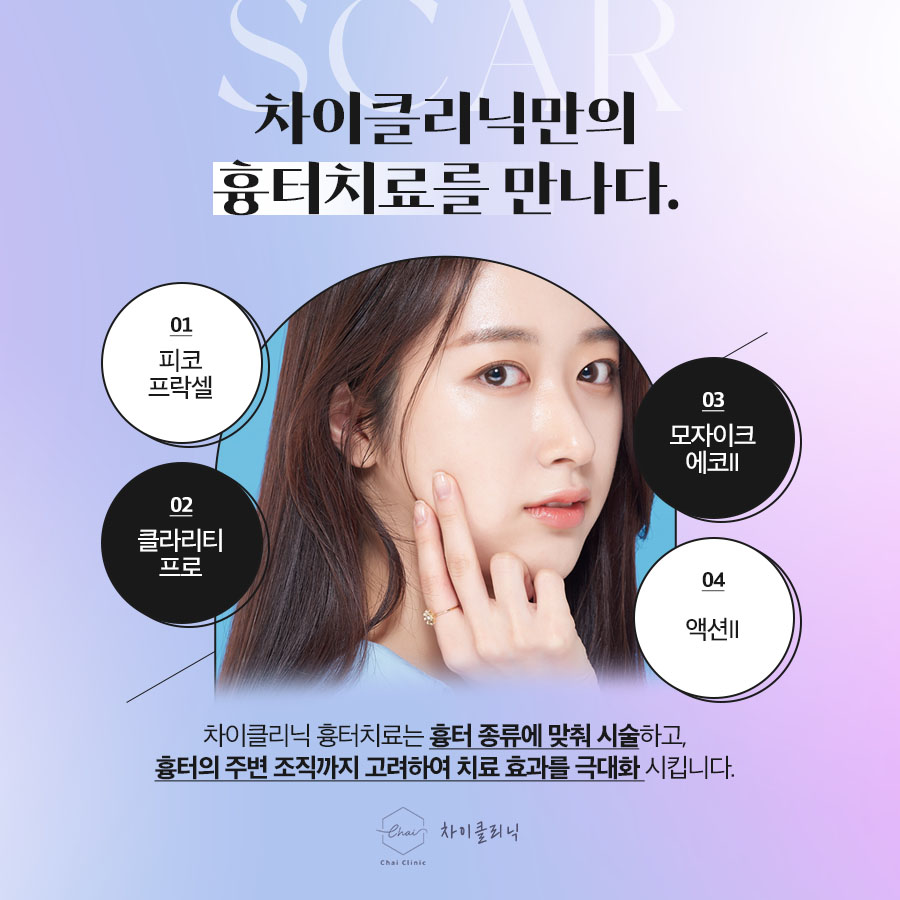 마포구피부관리 심해지기 전에 여드름치료 시작해야죠 관련 이미지 4