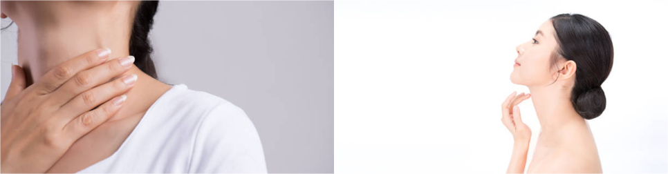 목리프팅 목주름을 확실하게 없애고 싶은 분들만 꼭 보세요. 관련 이미지 4