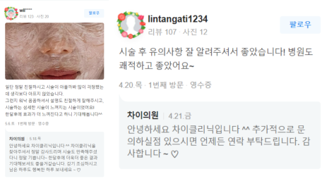 침샘보톡스가격 차이나는 이유와 효과, 진실 관련 이미지 19