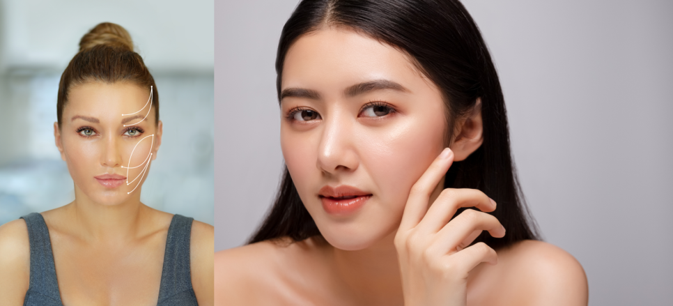 마포구피부관리 피부 탄력 높이는 특효약 실리프팅 관련 이미지 3