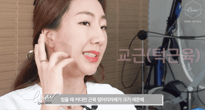 턱근육보톡스, 뭉침 있을 때 효과 제대로 보는 방법 관련 이미지 2