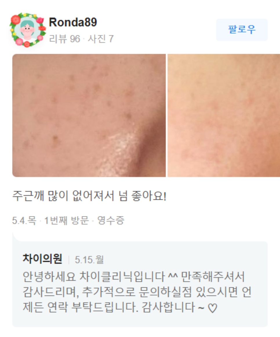 겨드랑이 레이저토닝 자신있게 핸즈업하려면 지켜야 할 것 관련 이미지 7