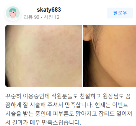 여드름 흉터 레이저, 피코프락셀과 같이 하면 좋은 것은? 관련 이미지 14