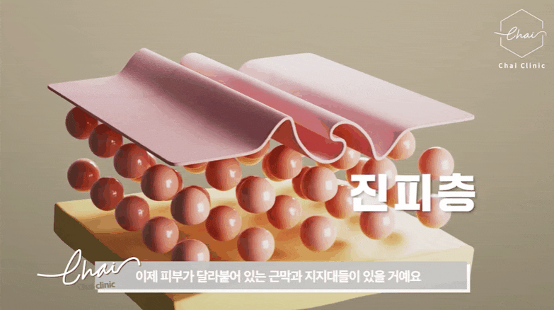 울써마지가격과 효과 모두 알려드립니다 관련 이미지 3