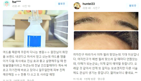울쎄라 인모드 차이 꼭 알고 나서 결정하세요 관련 이미지 15