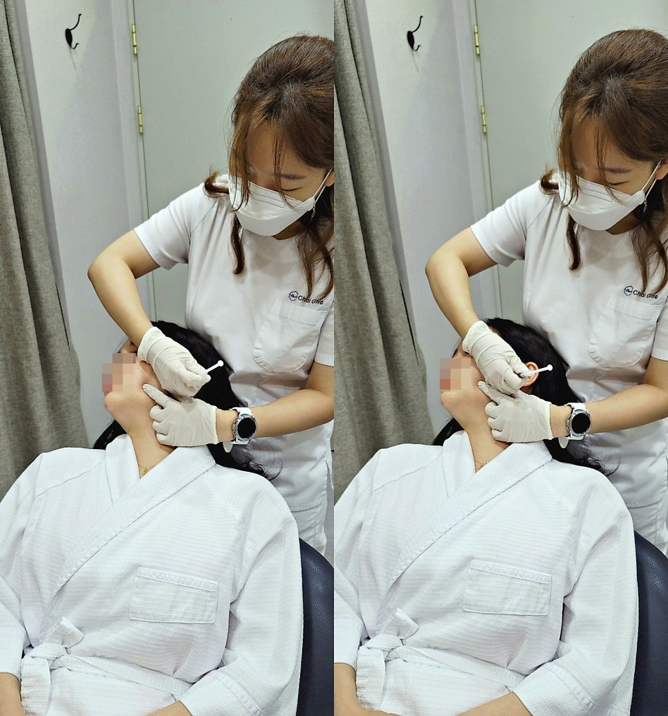 팔자주름 실리프팅 늘어지고 처진 피부를 당겨요! 관련 이미지 8