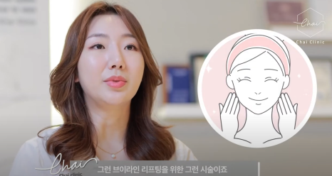 팔자주름리프팅 &lsquo;이것&rsquo;에 따라 효과가 달라져요 관련 이미지 10