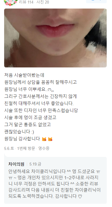 종아리알보톡스 시술로 하체 고민 해결! 관련 이미지 14