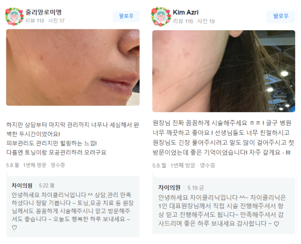 바디슈링크 처진 살 NO! 탄력 있는 라인 YES! 관련 이미지 14