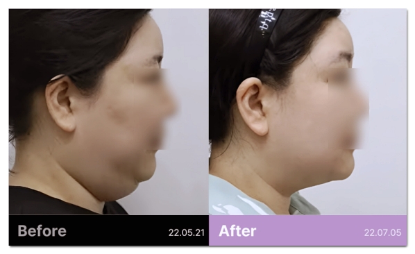 5 Things to Check Before Starting a Diet in Hapjeong image 5