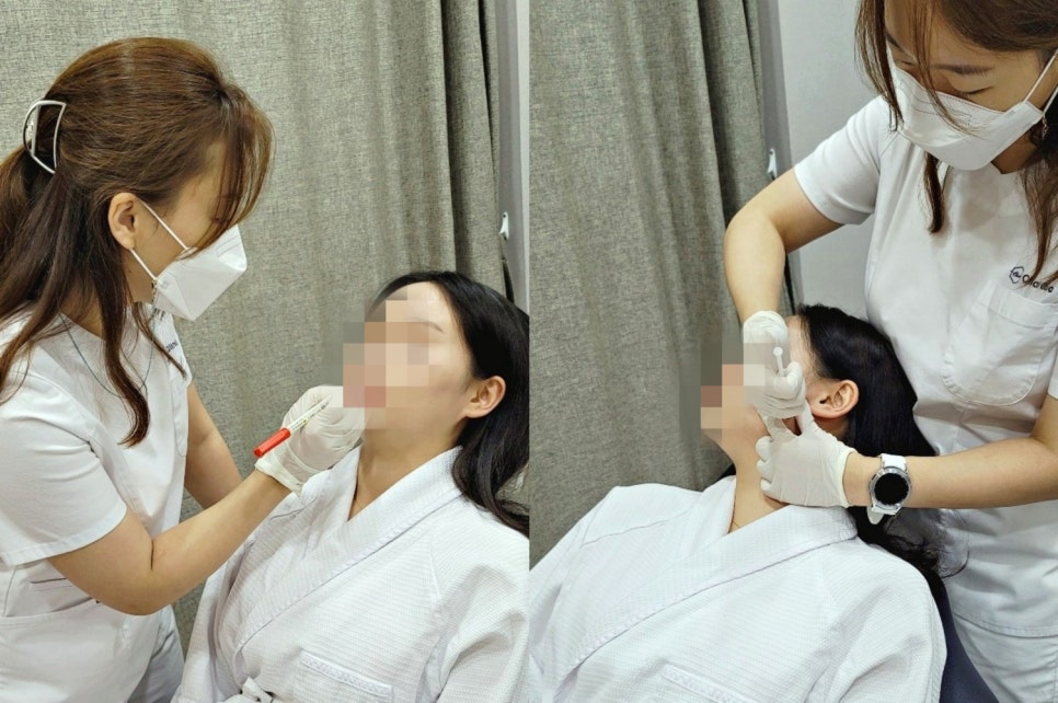 안면윤곽주사 주기부터 효과까지 전부 알려드립니다 관련 이미지 6