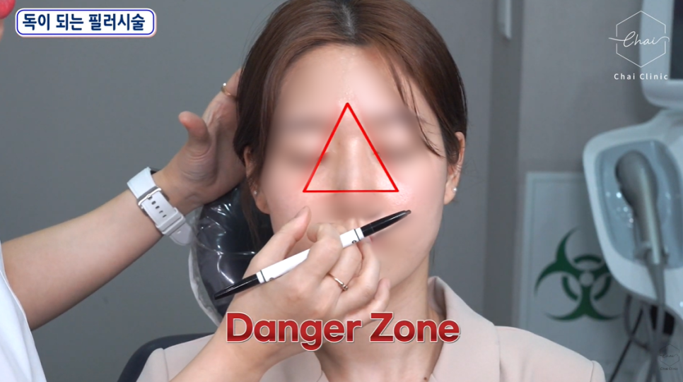 Three Things to Avoid for Safety After Filler Procedures image 3