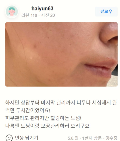 눈밑주름레이저 로 눈가 주름 고민 해결하세요 관련 이미지 20