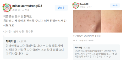 울쎄라팔자주름 울쎄라 실력자가 강조하는 &lsquo;이것&rsquo;! 관련 이미지 15