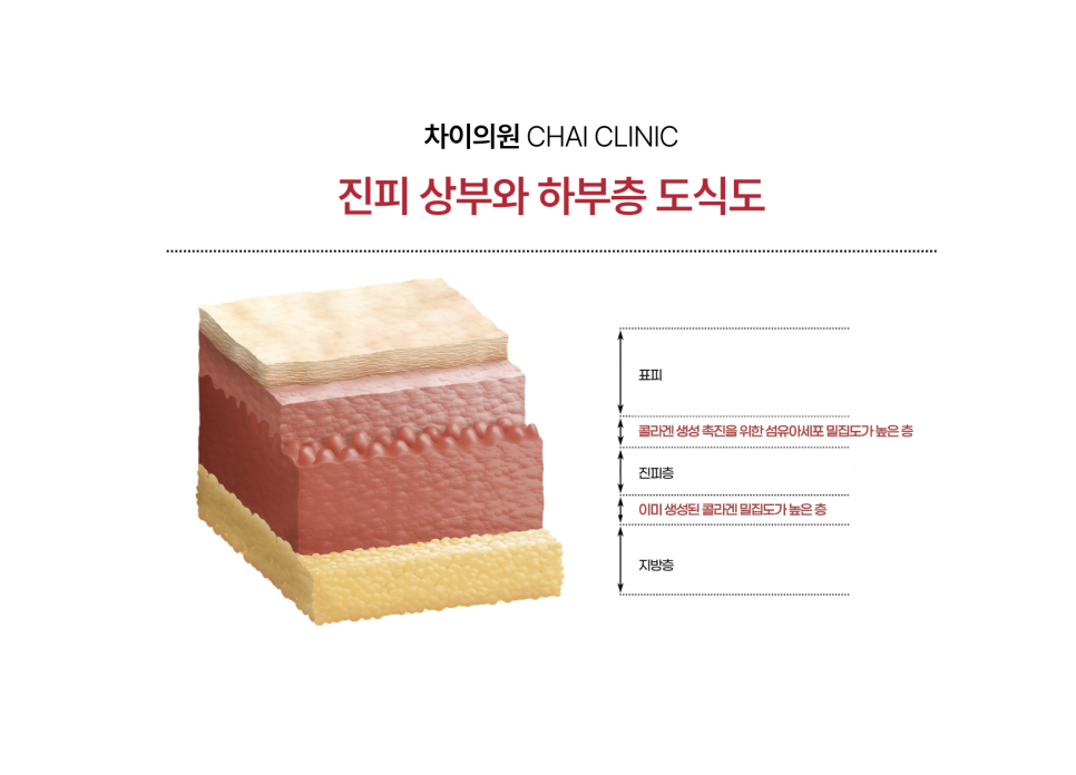 리쥬란 hb 후기에 대한 조원진 원장의 견해 관련 이미지 8