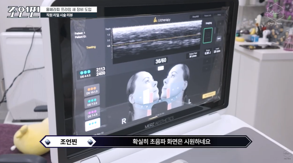 How to Improve the Effect of Hongdae Ultherapy Prime image 3
