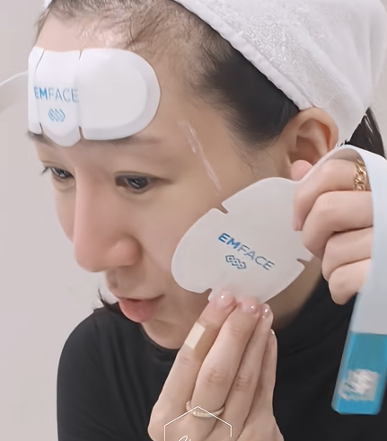 How to Reduce the Midface with EMFACE: A Midface Reduction Procedure image 5