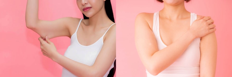 팔뚝 울핏 쉽고 빠르게 가녀린 팔 라인 완성 관련 이미지 4