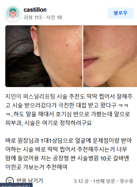 코레지리프팅, ‘이것’이 싫으신 분에게 추천! 관련 이미지 16