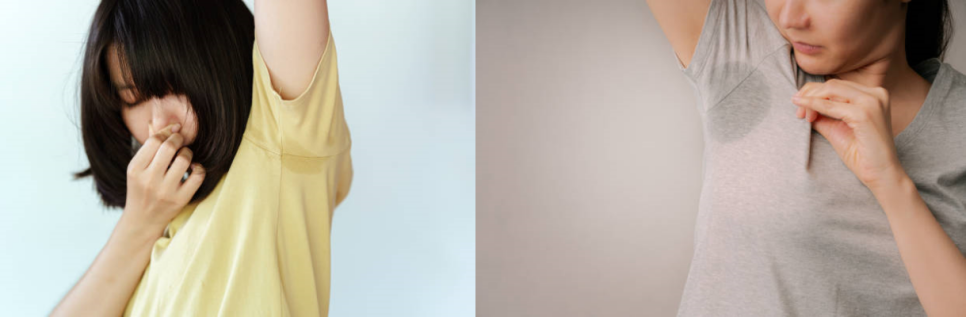 겨드랑이보톡스 다한증 치료에 효과적! 관련 이미지 2