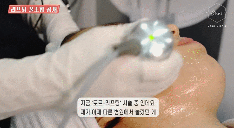 팔자주름시술? 자연스럽게 효과보는 방법 관련 이미지 11