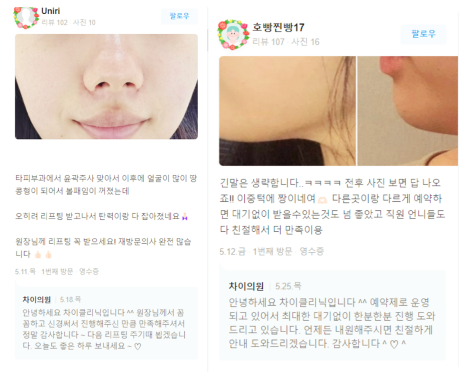 목리프팅 탄력저하 해결이 안 된다면 관련 이미지 16