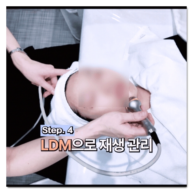 How to Choose a Good Lala Peel Clinic in Hongdae (What to Check During Your Consultation) image 5