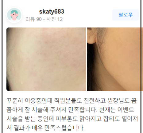 코모공 프락셀 넓어진 부위를 개선하는 방법! 관련 이미지 16