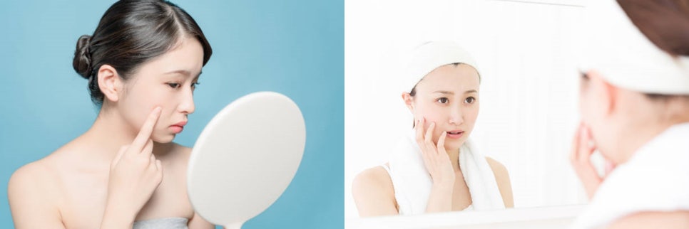 합정피부관리, 어디서 할지 고민일 때 클릭! 관련 이미지 2