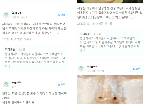 토르리프팅 통증과 부작용은 낮추며 효과는 최대로! 관련 이미지 12