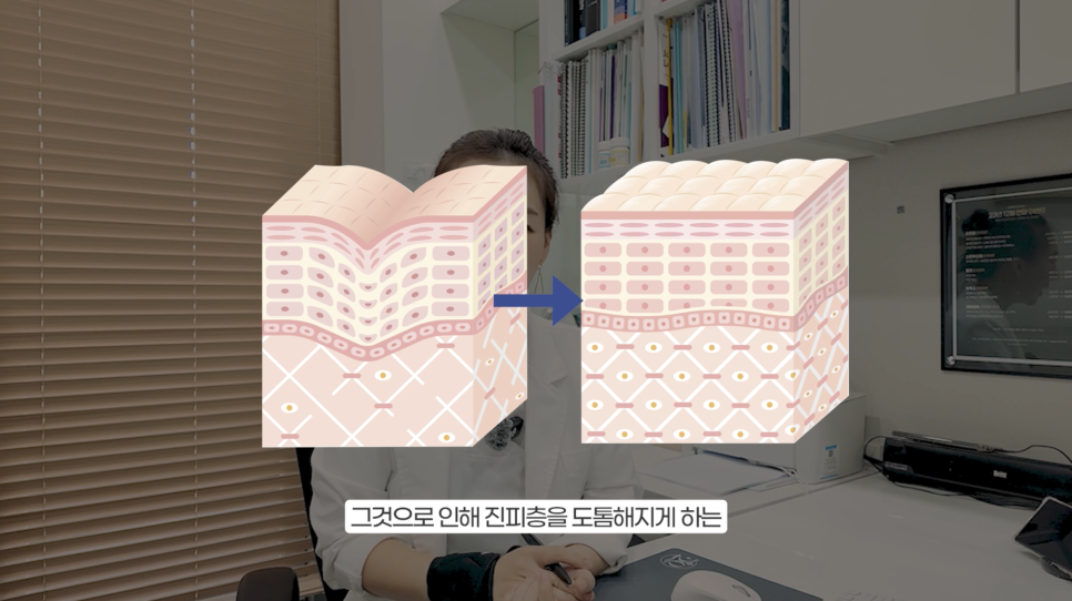 아무도 알려주지 않는 쥬베룩 볼륨 효과 관련 이미지 7
