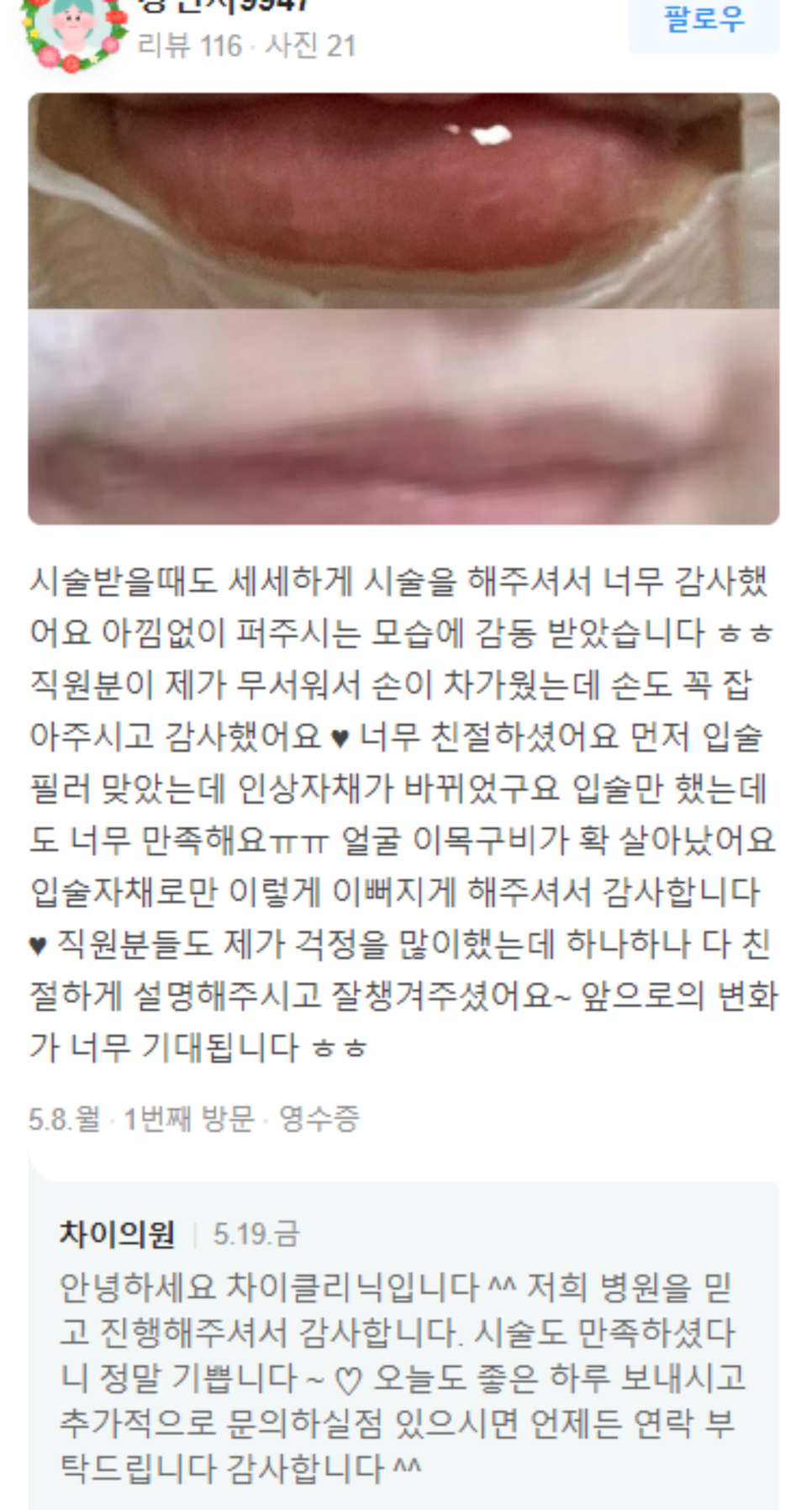 쥬베룩 효과 올리는 피부관리 제대로 받는 방법 관련 이미지 12