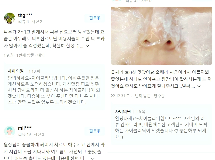 남자리프팅 효과 관련 이미지 7
