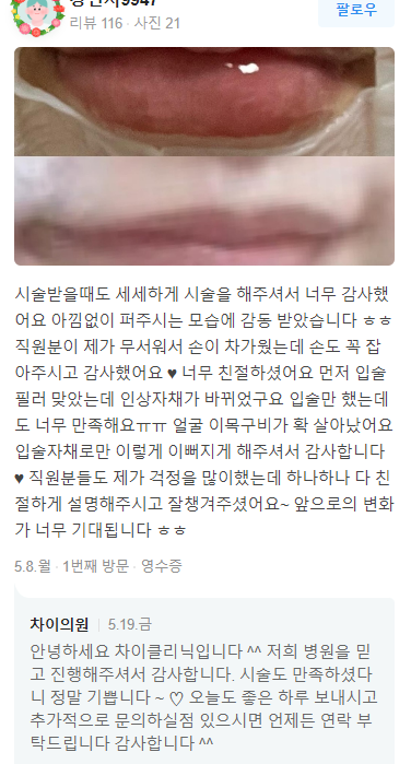 종아리보톡스가격 만 고려하면 큰 코 다치는 이유 관련 이미지 17
