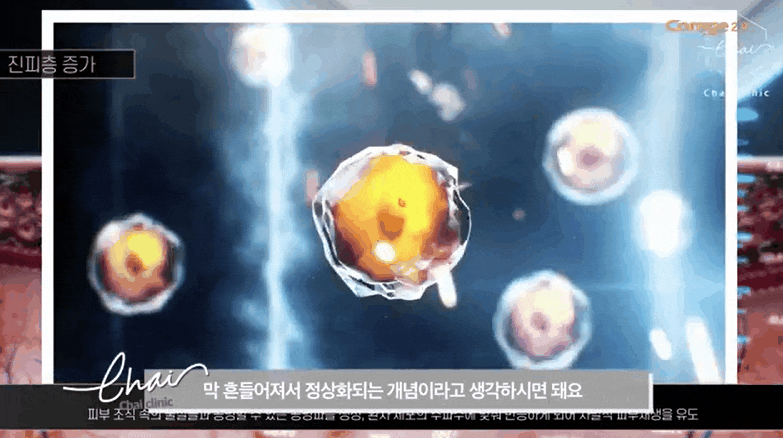 홍대피부관리 떨어지는 피부 탄력 확실하게 리프팅 하는 비결 (근처10분거리) 관련 이미지 10