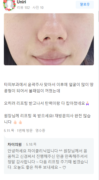 눈가주름보톡스 주름도 인상도 확 펴고 싶다면! 관련 이미지 17
