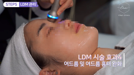 신촌역피부관리 빨리 예뻐져야 할 때 필요한 시술 관련 이미지 9