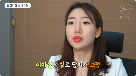 신촌피부관리 차이의원에서 리프팅으로 젊음을 되찾는 방법 관련 이미지 12
